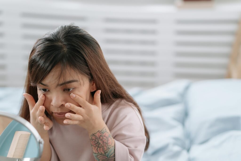 Olhos inchados pela manhã? 11 causas e tratamentos respaldados por especialistas 1 Olhos inchados pela manhã? 11 causas e tratamentos respaldados por especialistas