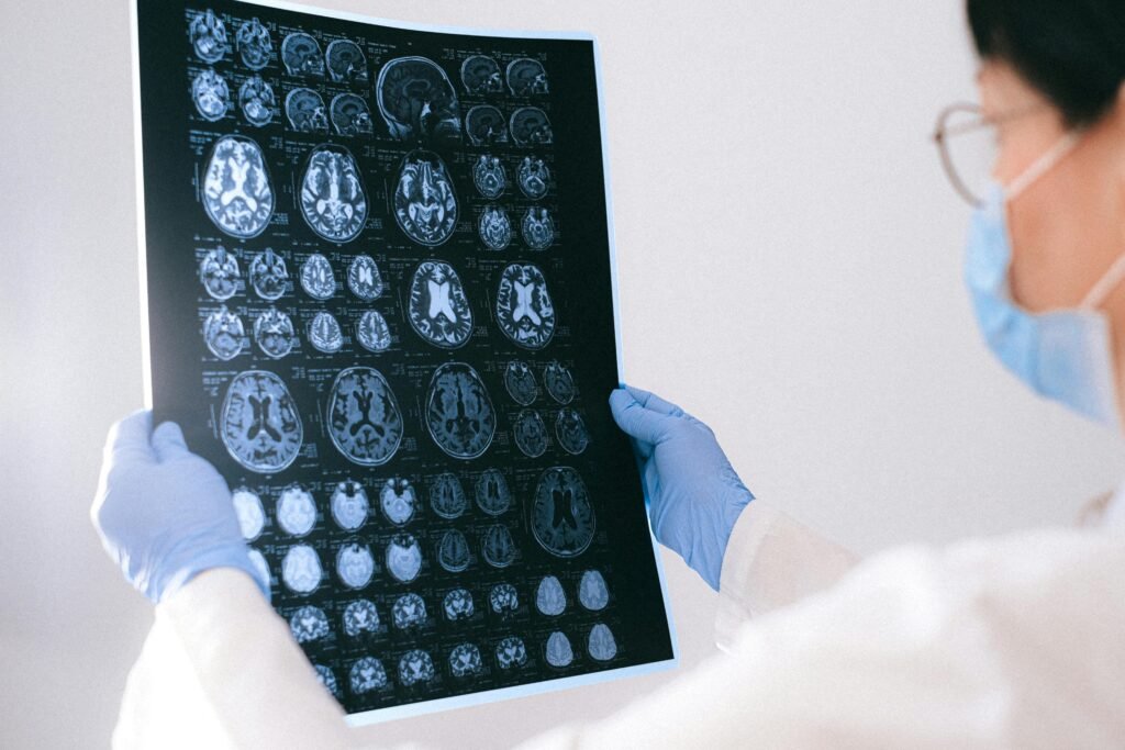 Alimente seu cérebro: como a dieta pode prevenir o Alzheimer? 1 Alimente seu cérebro: como a dieta pode prevenir o Alzheimer?