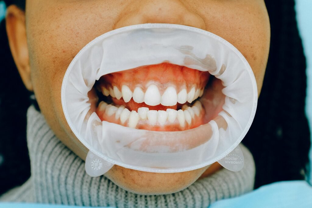 Tudo o que Você Precisa Saber Sobre Saúde Oral e Sorriso Brilhante 1 Tudo o que Você Precisa Saber Sobre Saúde Oral e Sorriso Brilhante