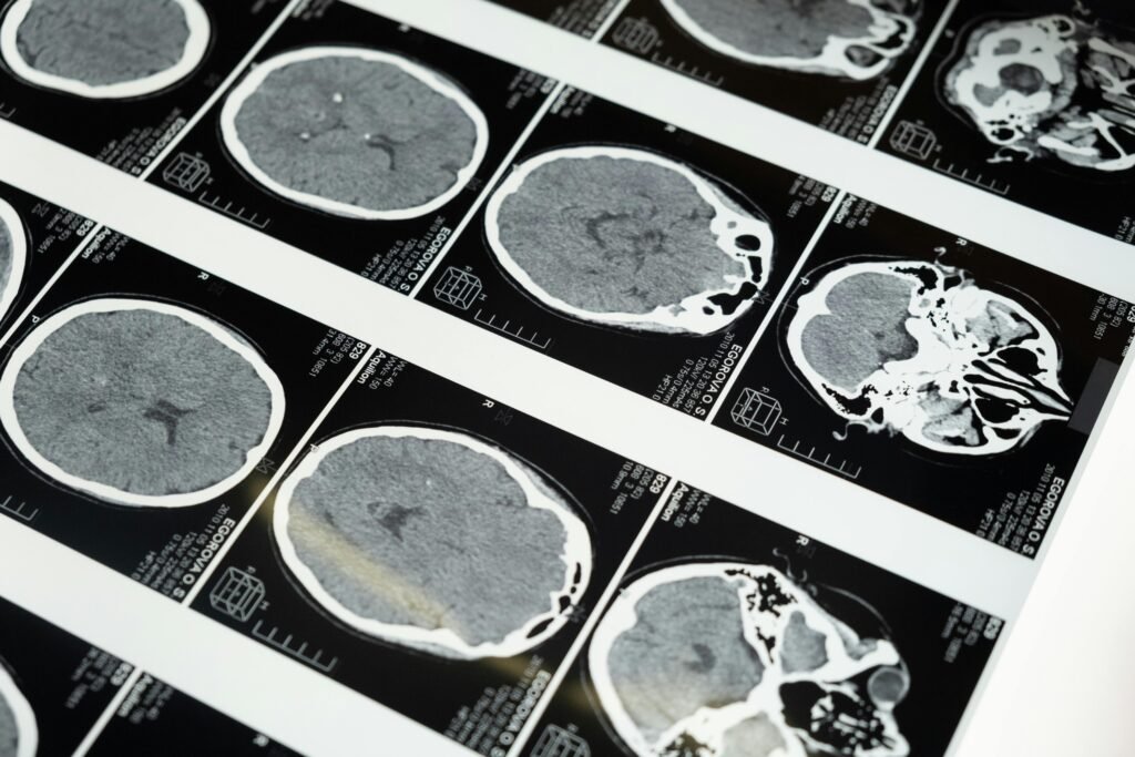 Pesquisa sobre o impacto dos ácidos graxos ômega-3 na saúde cerebral e no envelhecimento 1 Pesquisa sobre o impacto dos ácidos graxos ômega-3 na saúde cerebral e no envelhecimento
