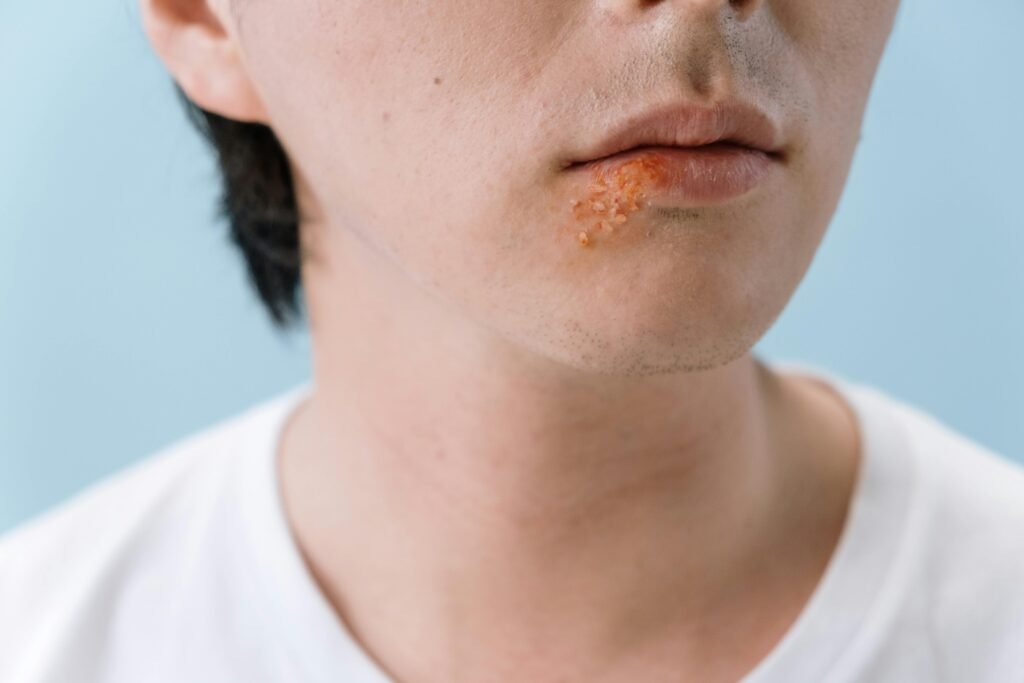 Salmonela no prato: reconhecendo os sinais da infecção e prevenindo a doença 1 Salmonela no prato: reconhecendo os sinais da infecção e prevenindo a doença